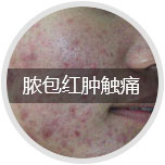 ŧ�����״�ʹ