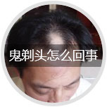 ����ͷ��ô����