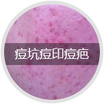 ���Ӷ�ӡ����